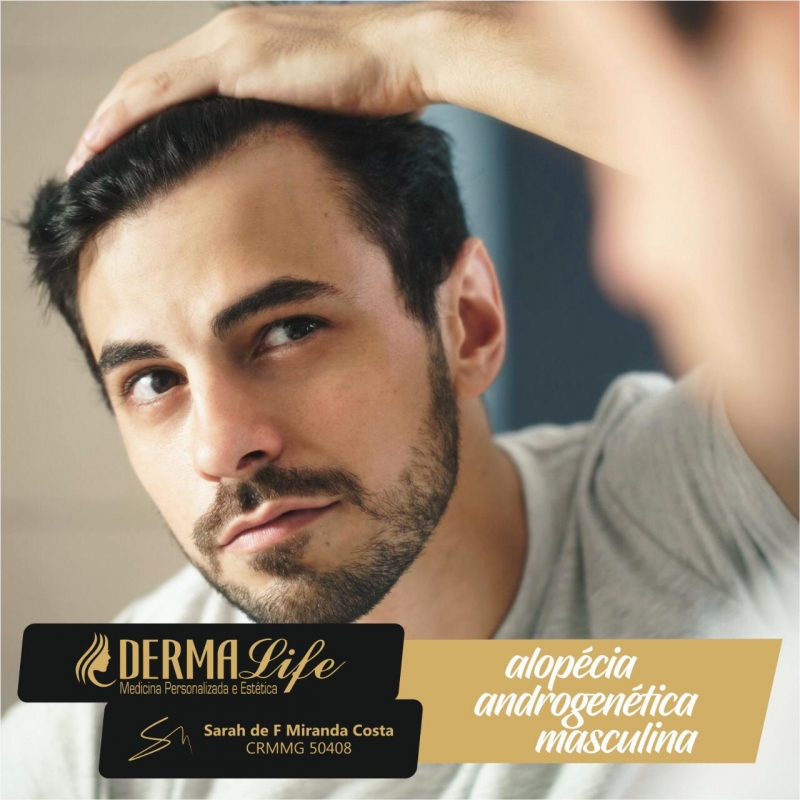 Vamos investigar a maior causadora de calvície masculina!