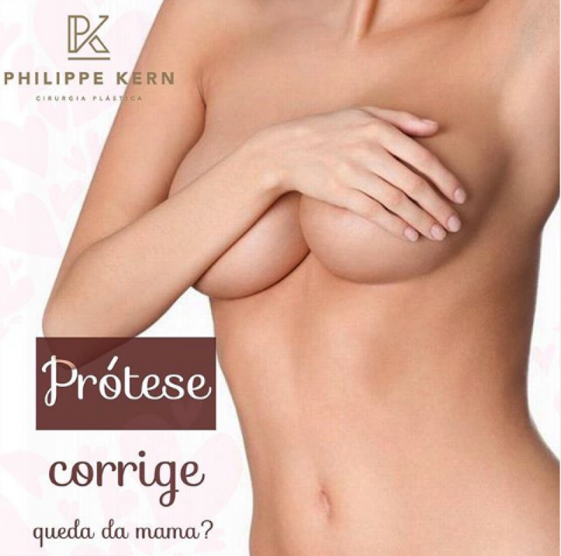  A prótese de mama corrige aquela mama que esta com ptose(queda)?