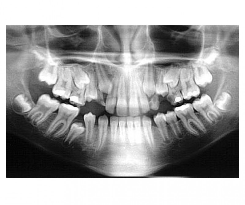 Radiografias Odontológicas