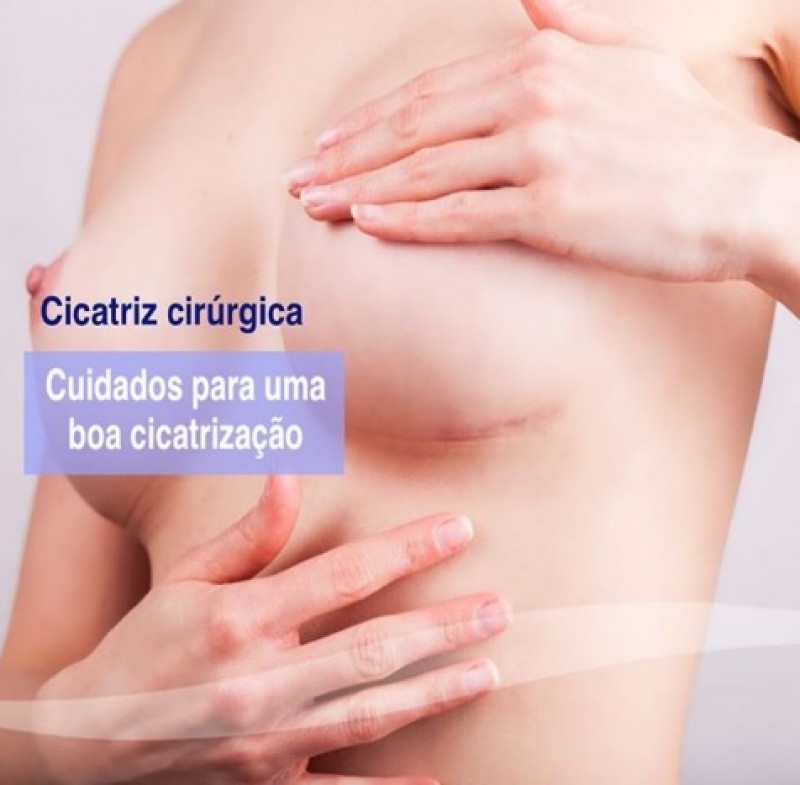 Cuidados para uma boa cicatrização