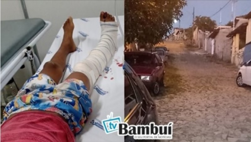 Menino de 10 anos é atacado por cachorro da raça Pitbull em Bambuí