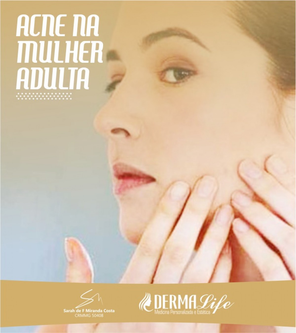 Acne na mulher adulta
