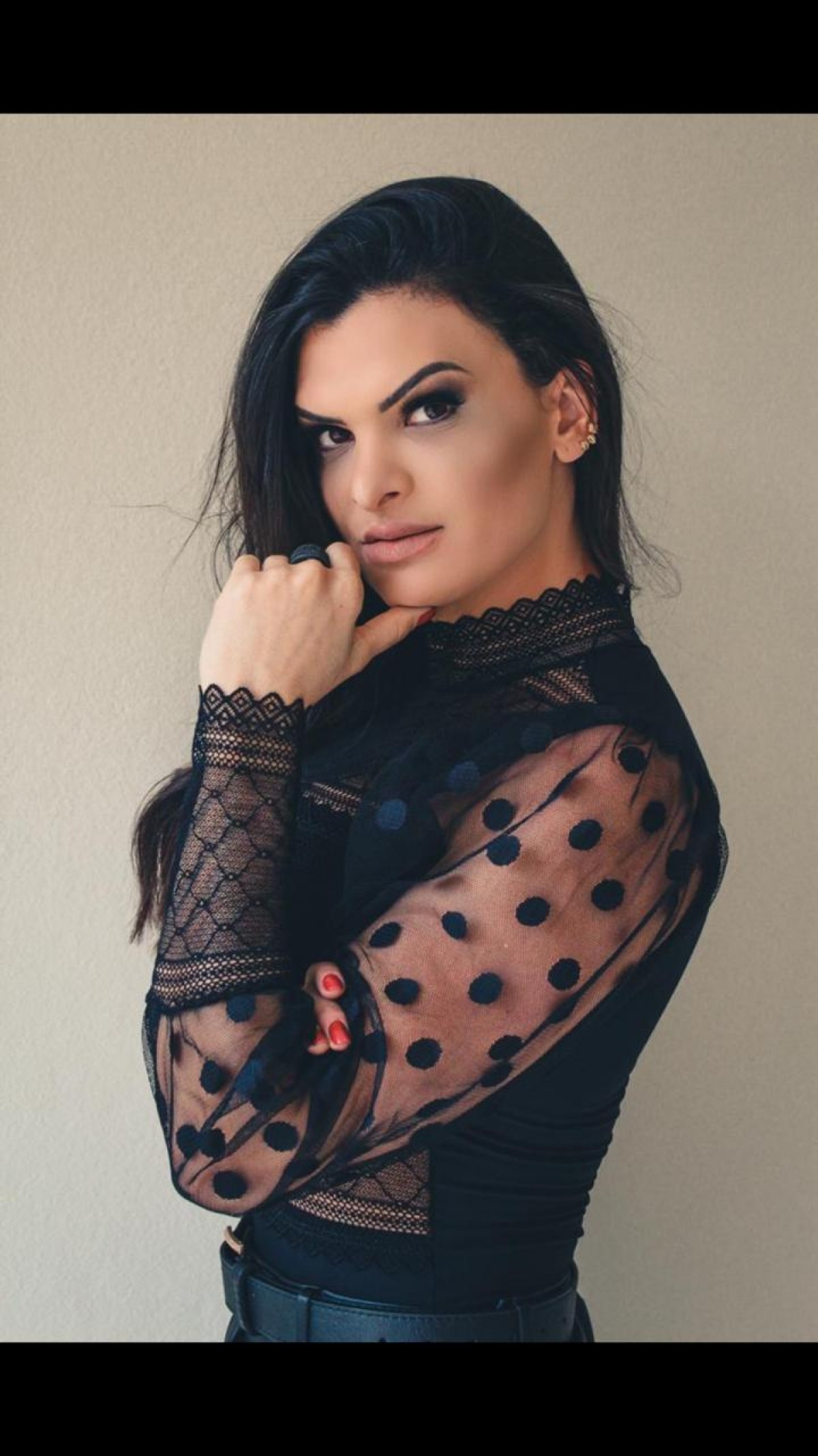 Vamos falar sobre o queridinho de todos? O Botox