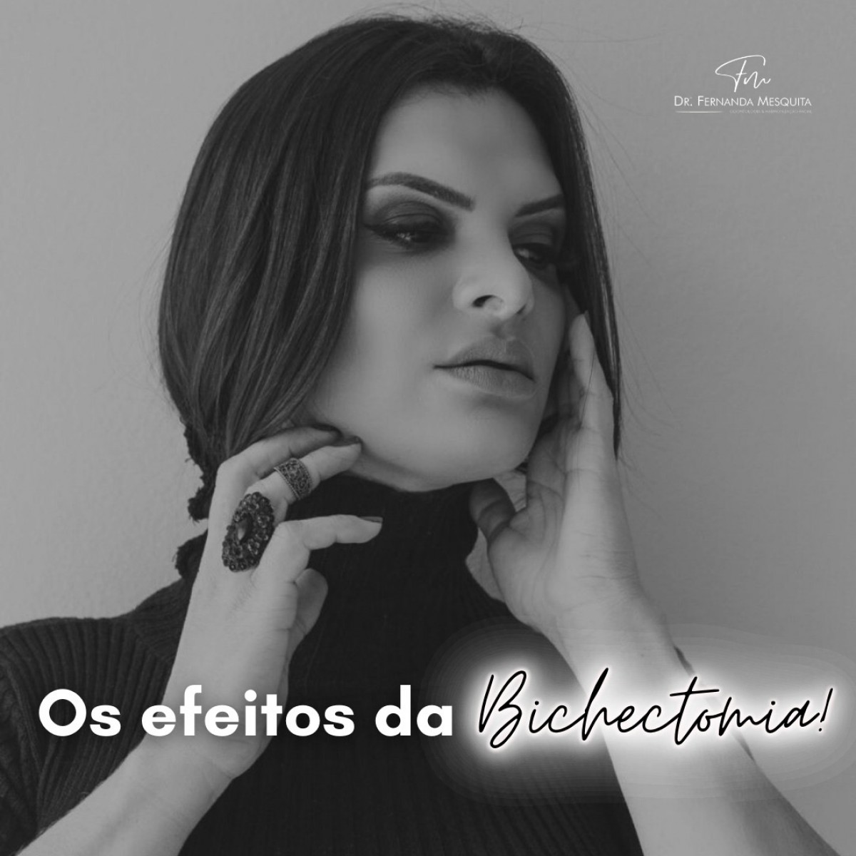 Você sabia que a gordura da bochecha que retiramos na bichectomia ela não volta mais?