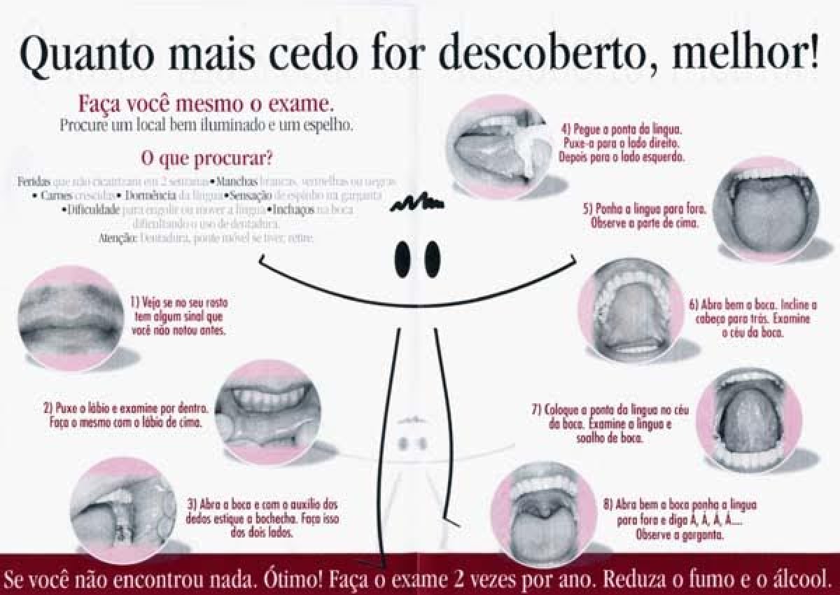 Prevenção do Câncer Bucal