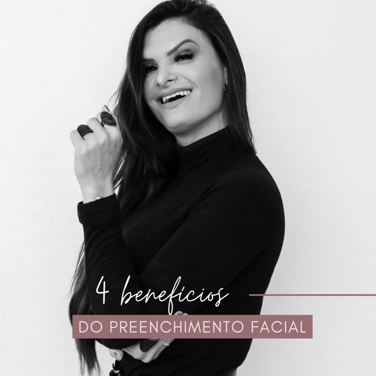 4 benefícios do preenchimento facial