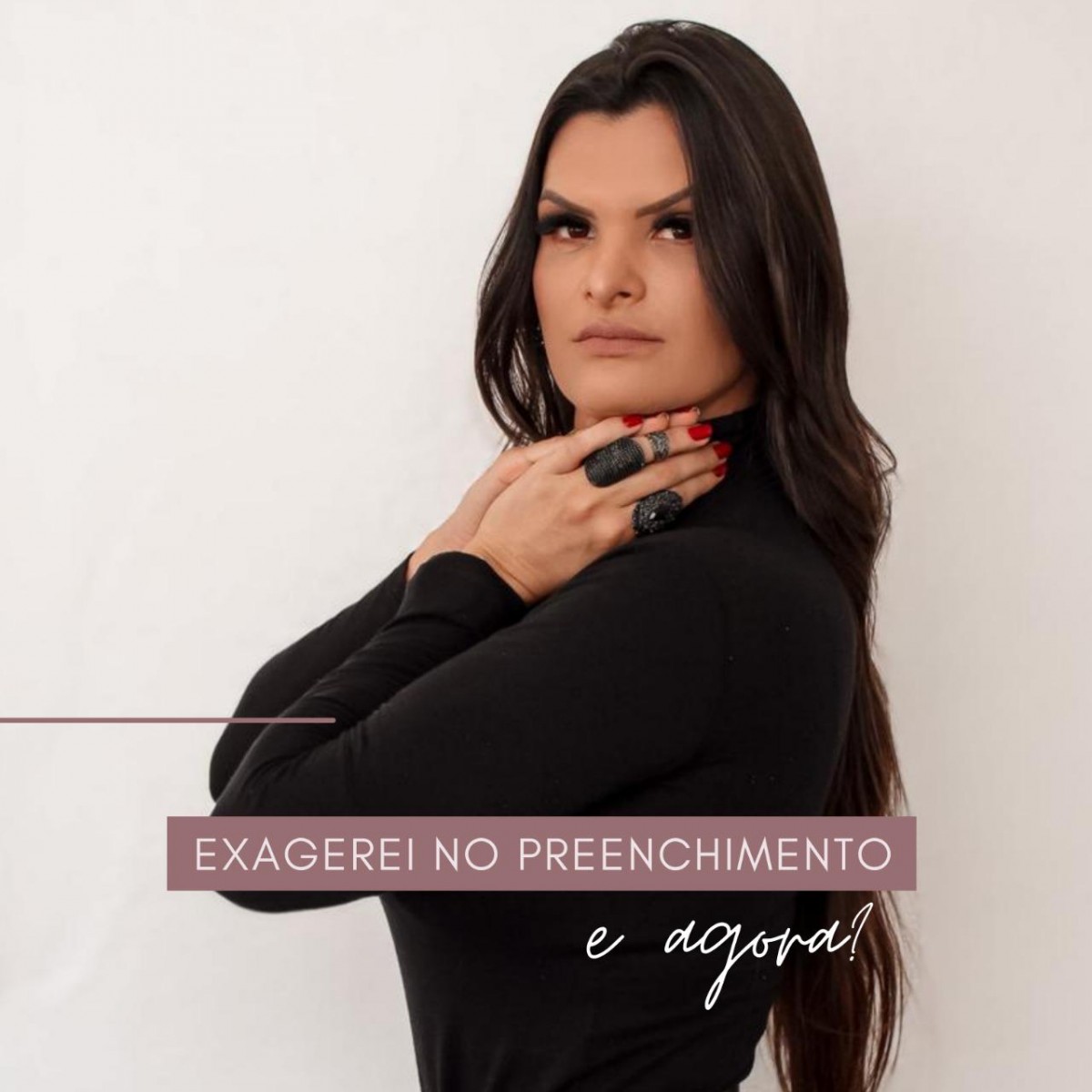 Exagerei no preenchimento e agora?
