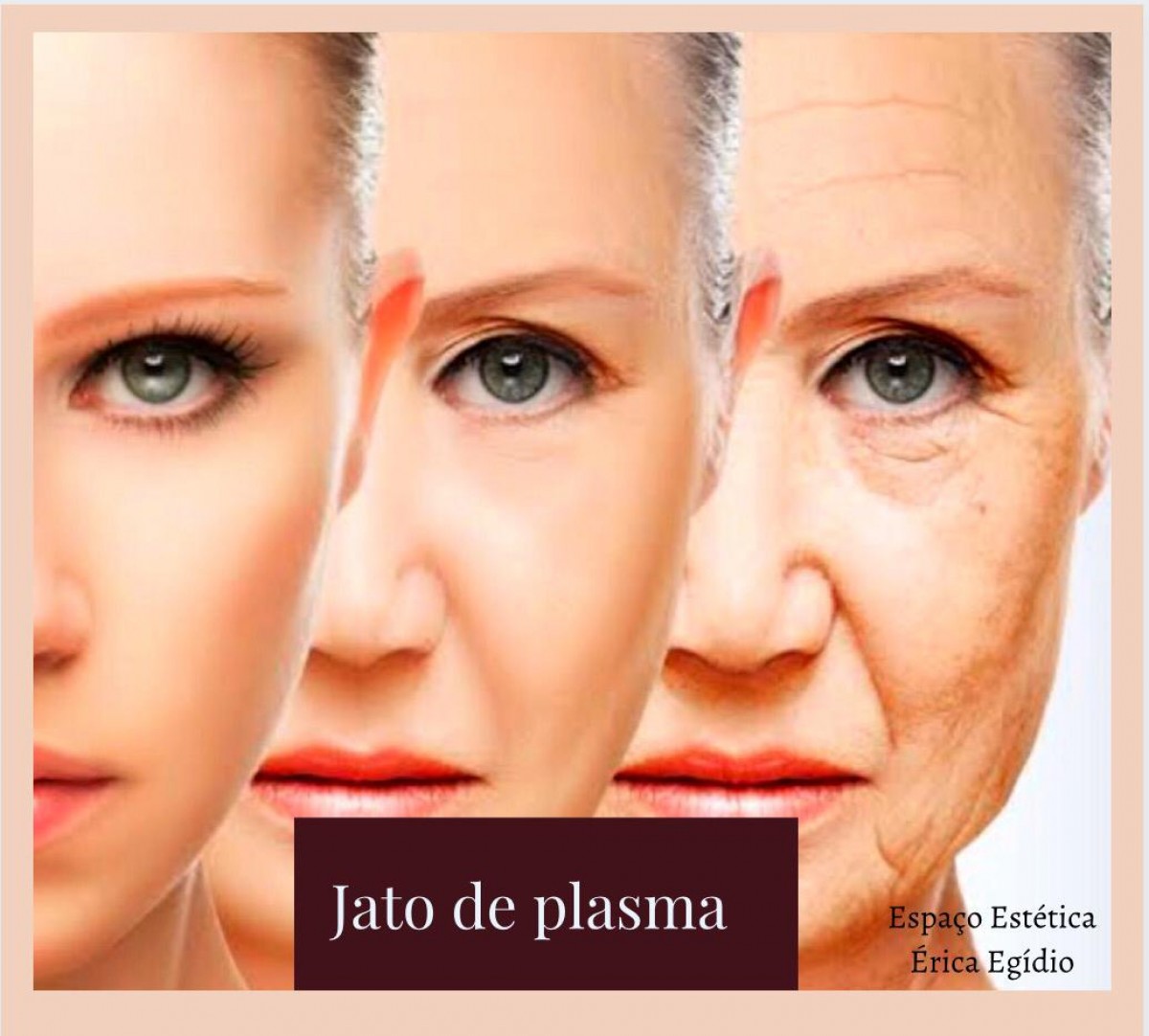 Você conhece o jato de plasma?