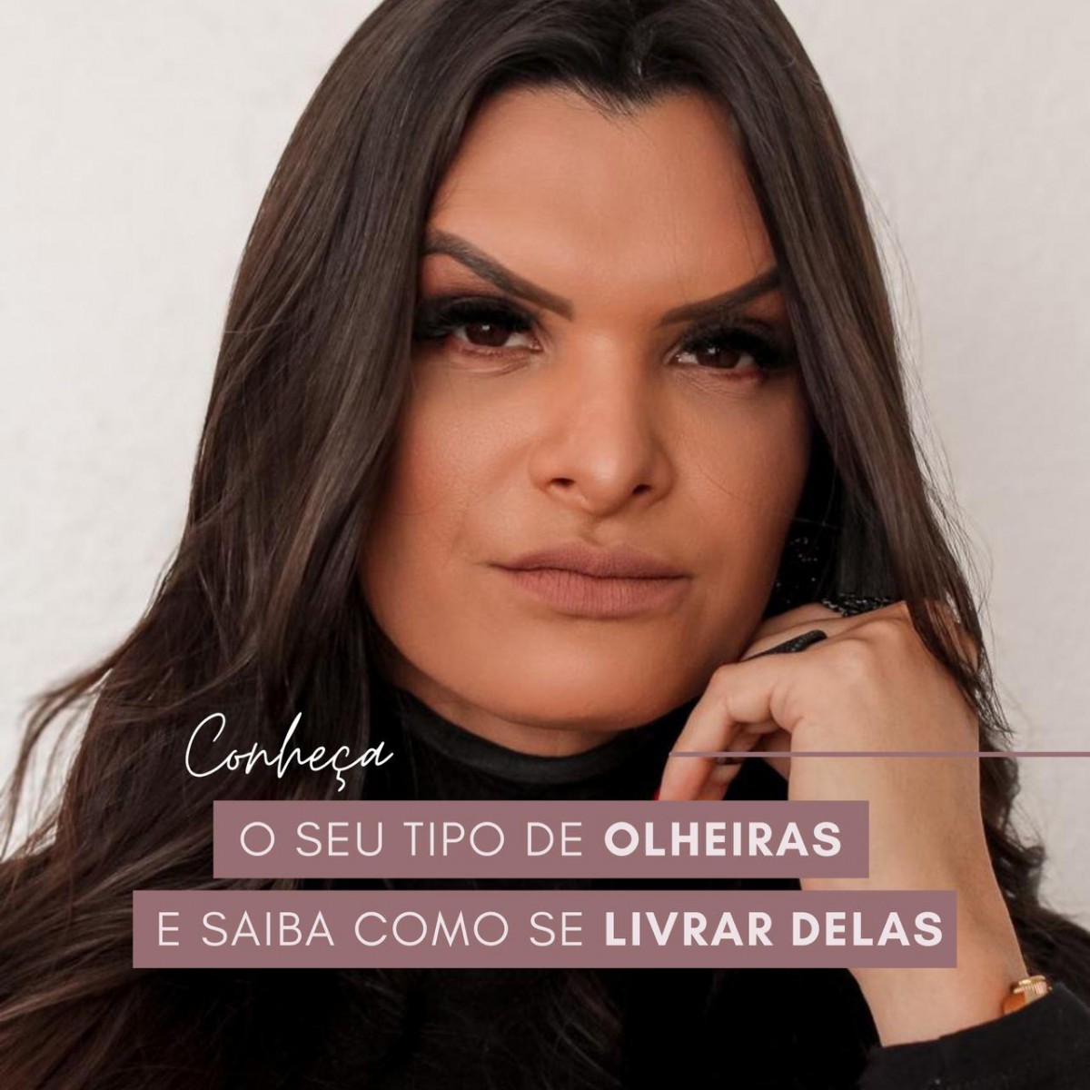 Conheça o seu tipo de olheiras e saiba como se livrar delas