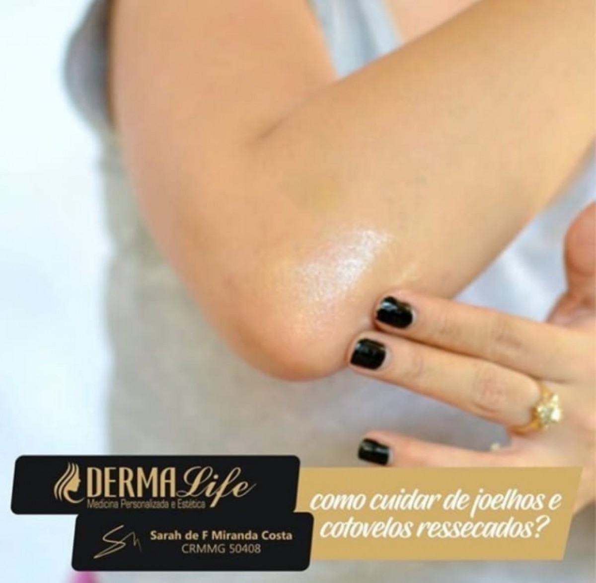 Como cuidar de joelhos e cotovelos ressecados?