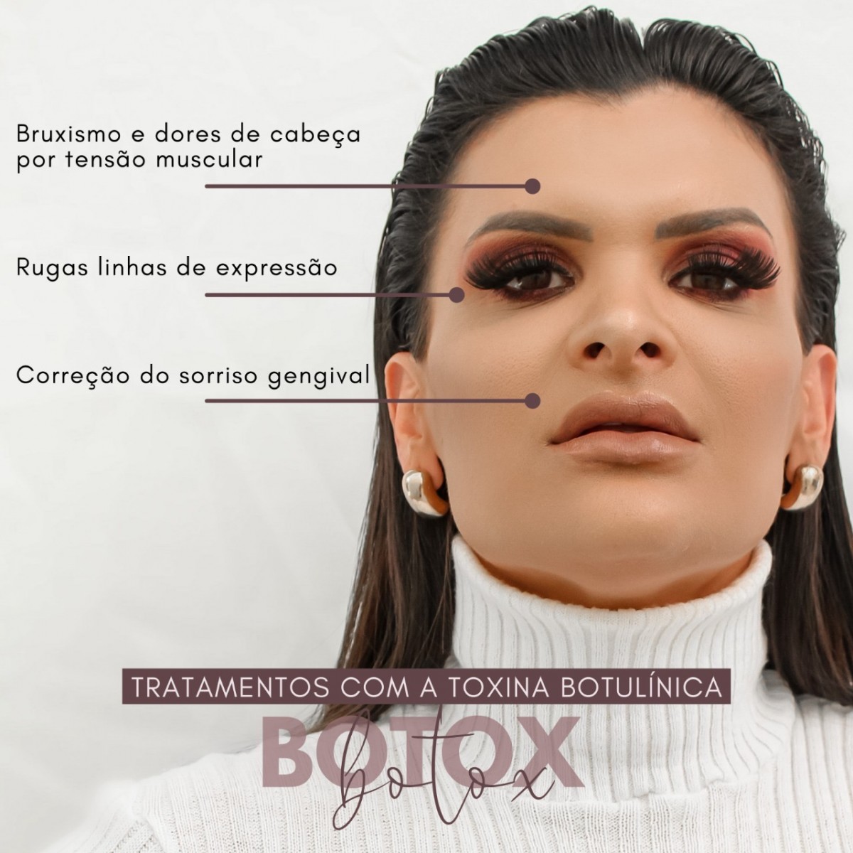 Tratamentos com a toxina botulínica