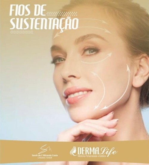 O que são fios de sustentação? Venha conhecer sobre