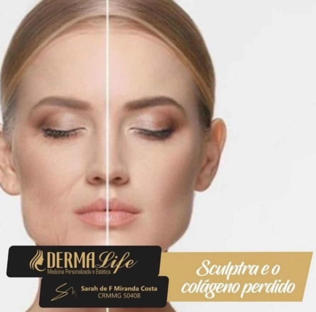 Você conhece os benefícios do bioestimulador de colágeno que é super poderoso?