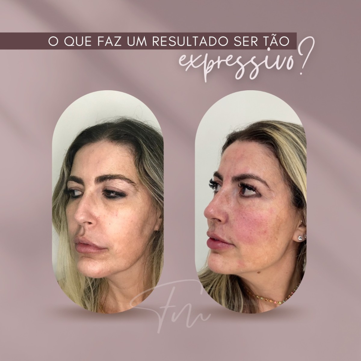 O que faz um resultado ser tão expressivo?