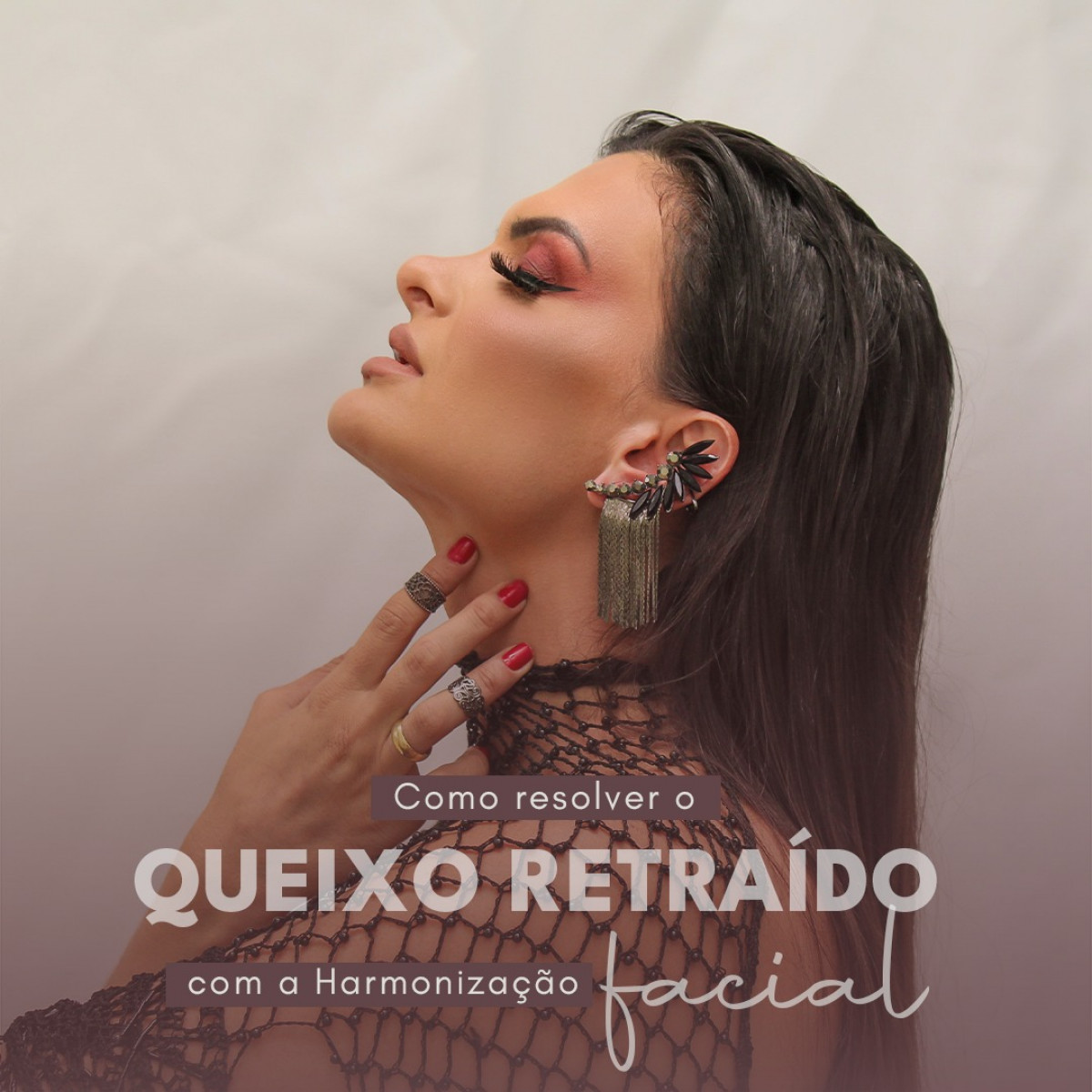 Como resolver o queixo caído?