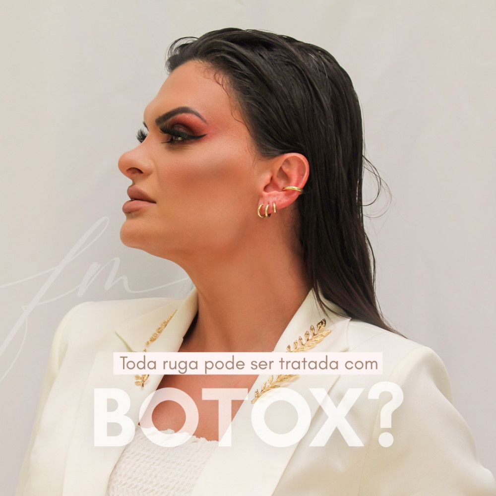 Toda ruga pode ser tratada com Botox?