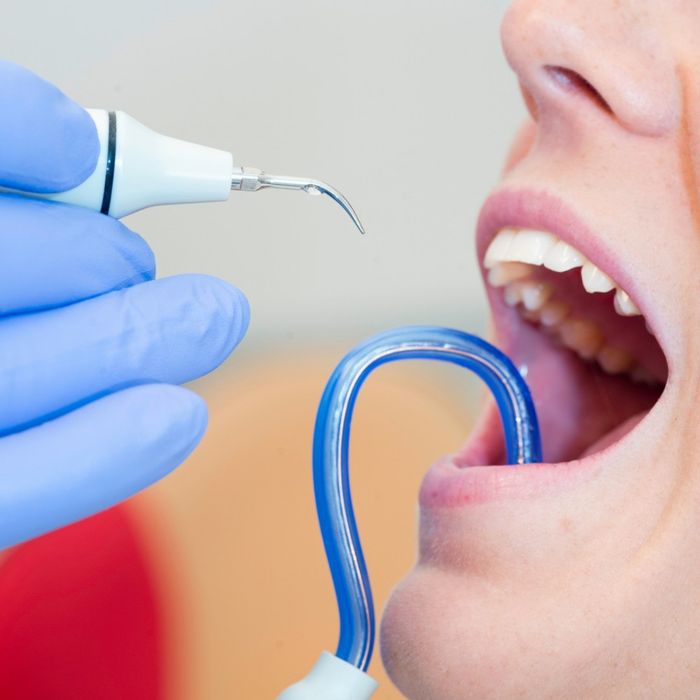 A importância da Limpeza Odontológica Profissional