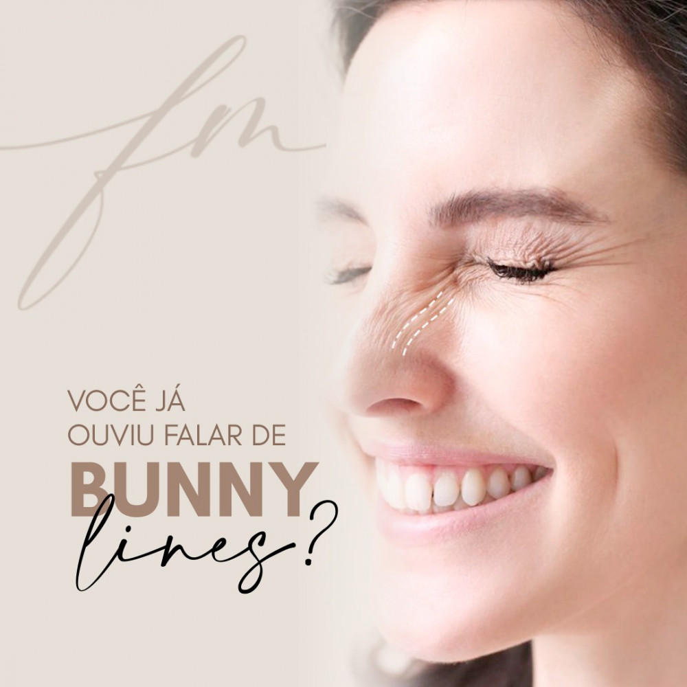 Você já ouviu falar de Bunny Lines?