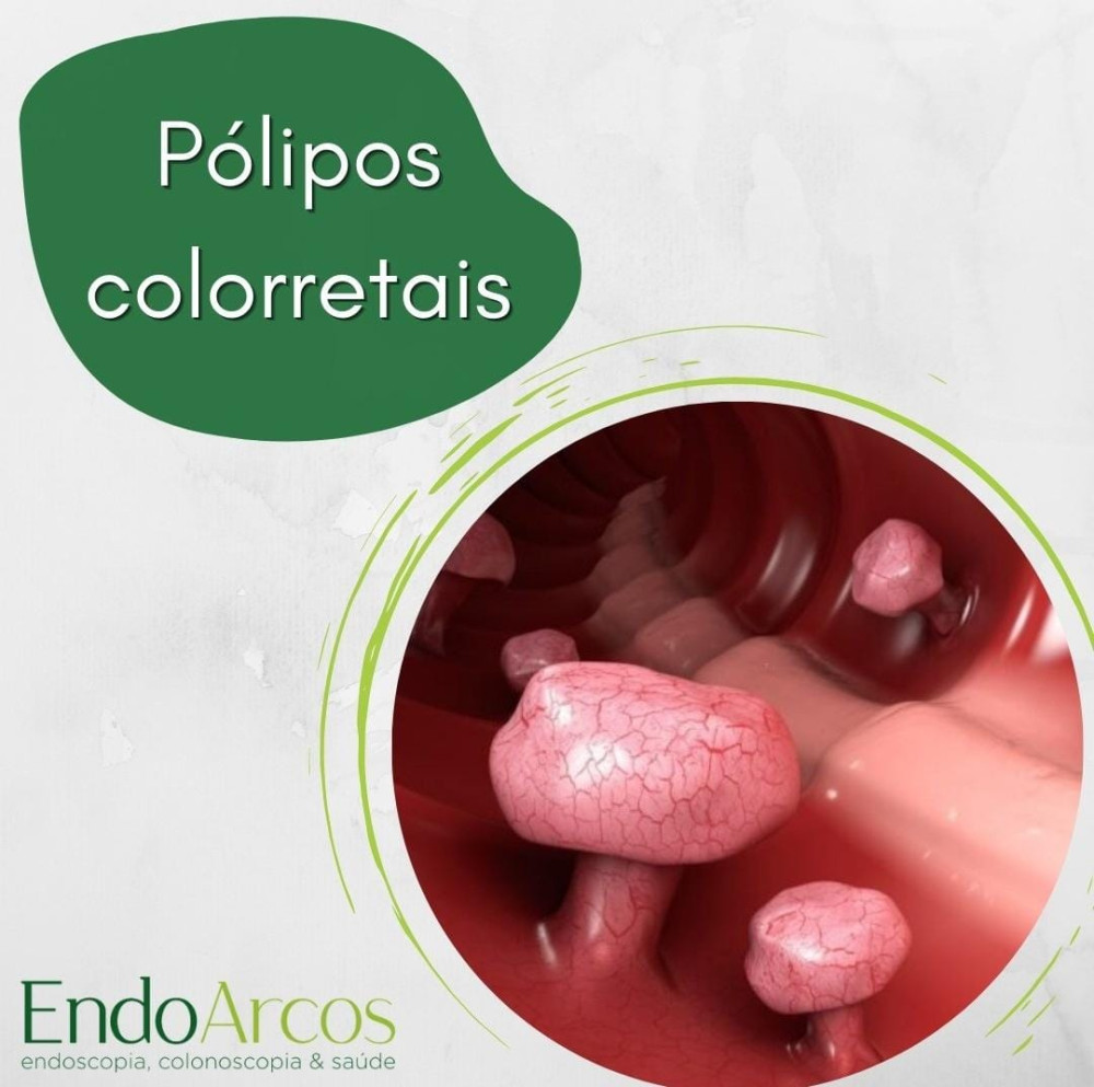 PÓLIPOS COLORRETAIS