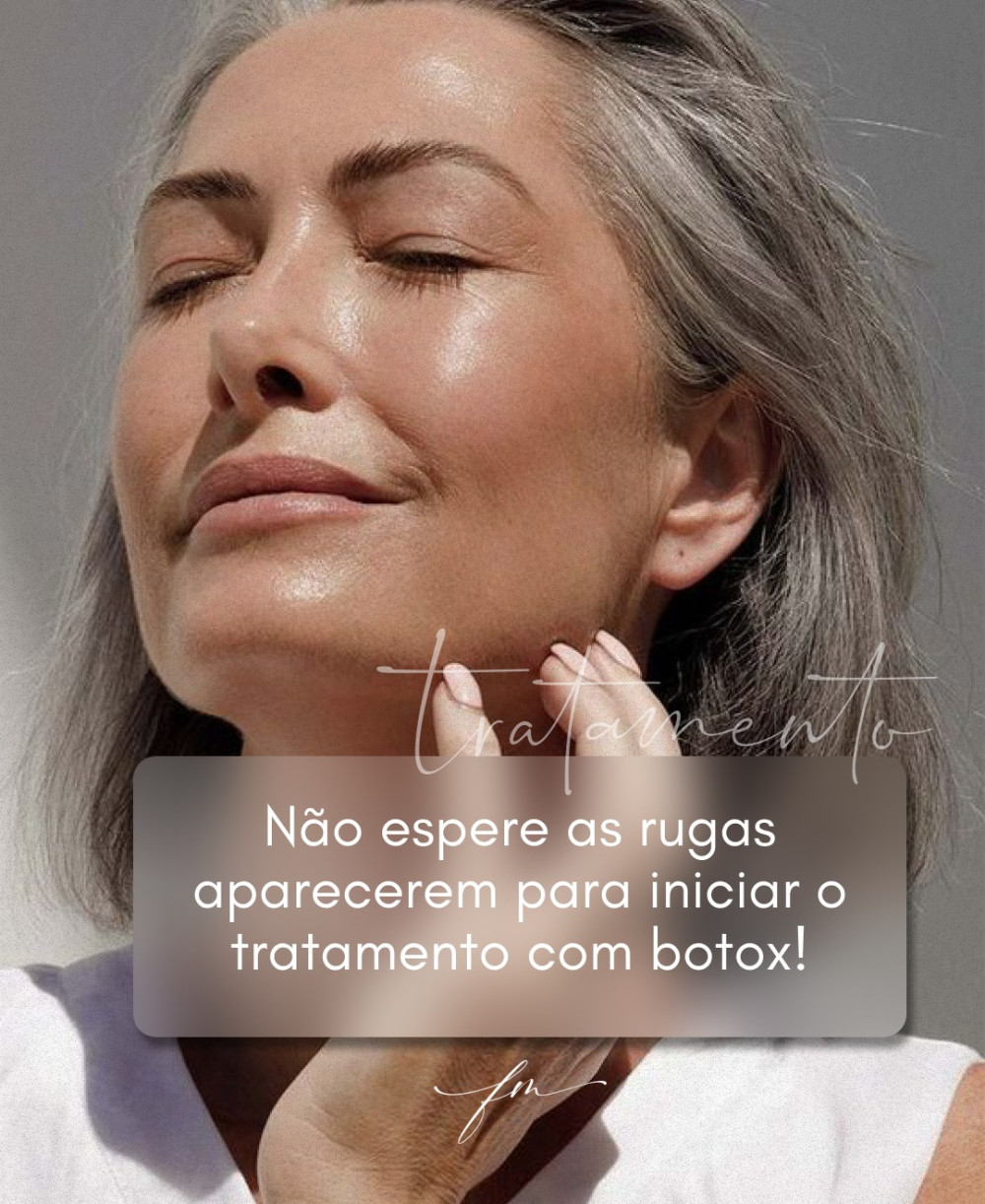Não espere as rugas aparecerem para iniciar o tratamento com botox!