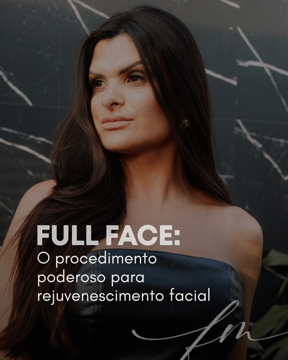 Full Face: O procedimento poderoso para rejuvenescimento facial