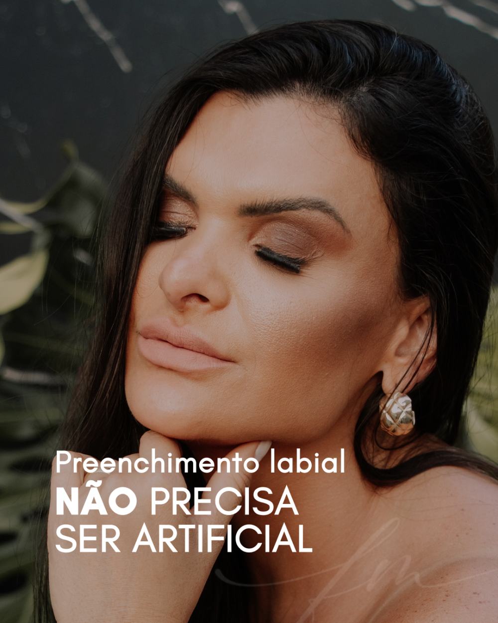 Preenchimento labial não precisa ser artificial