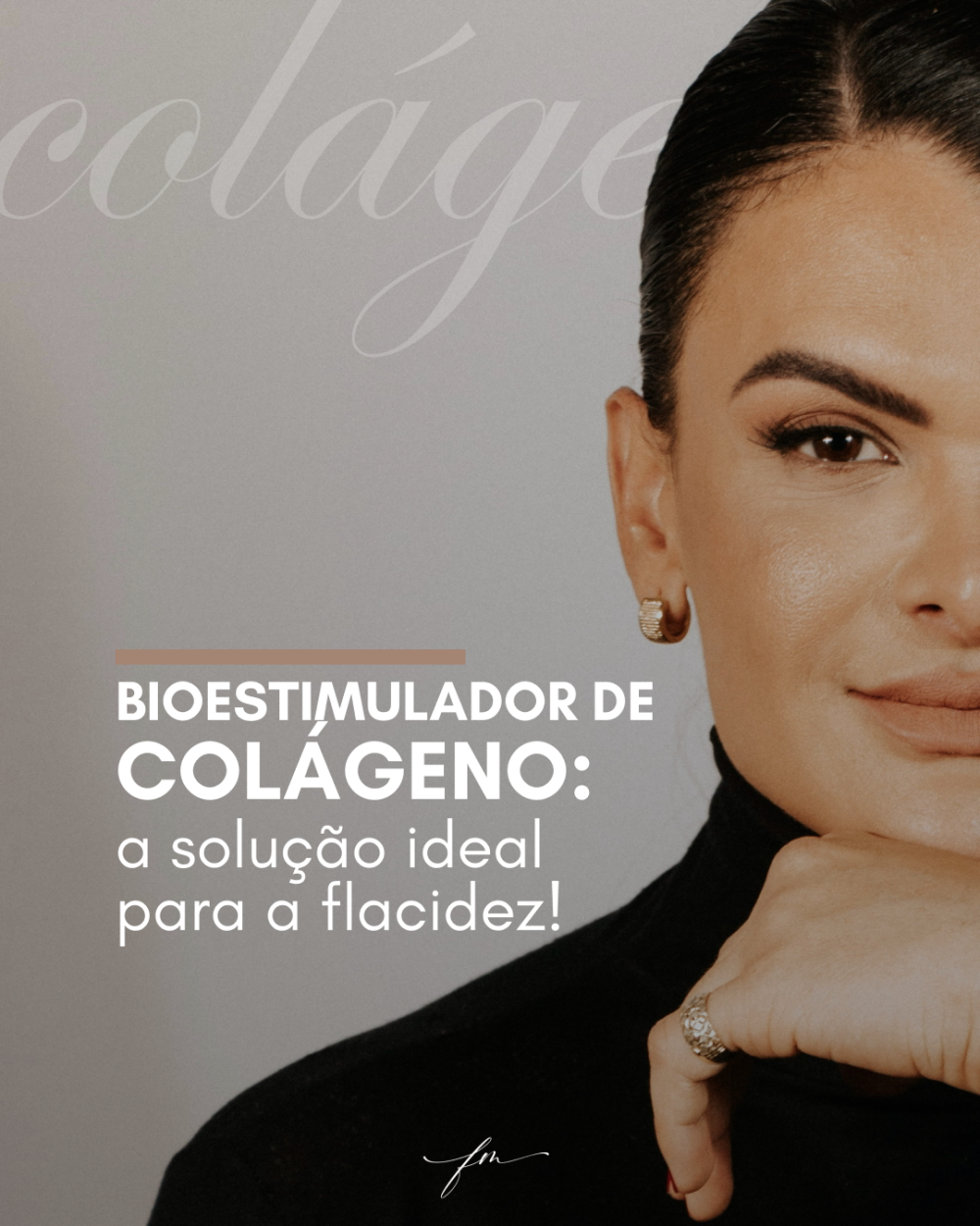 Bioestimulador de Colágeno: a solução ideal para a flacidez!