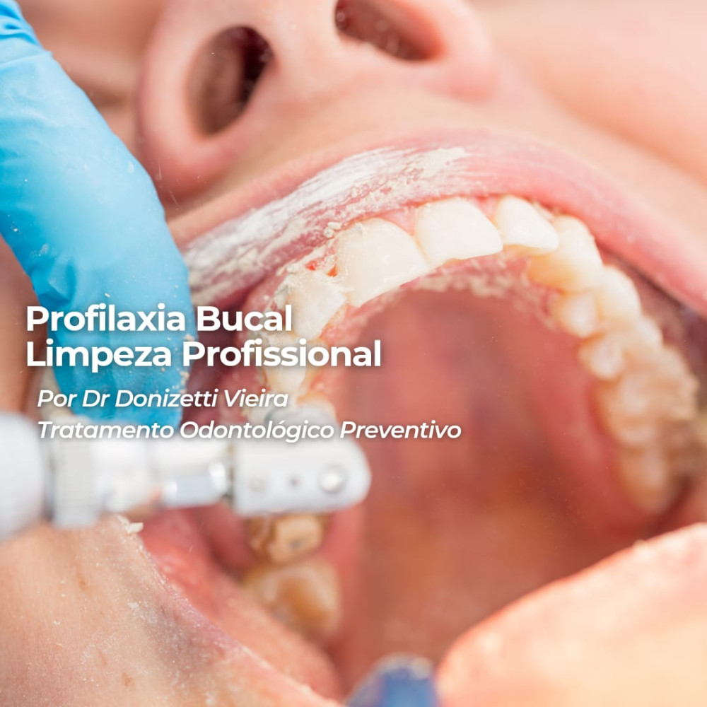 Profilaxia bucal e limpeza profissional