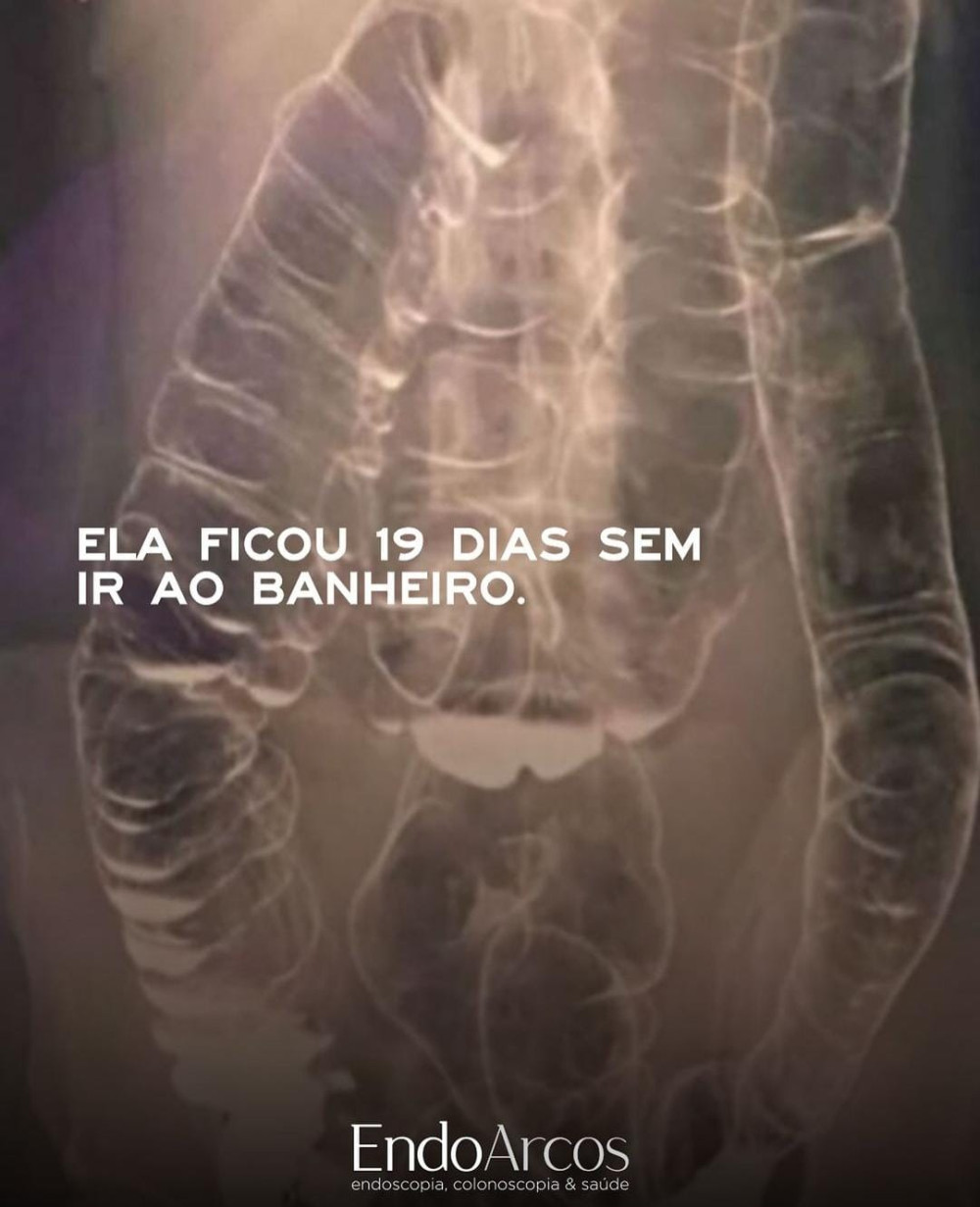 Ela ficou 19 dias sem ir ao banheiro!