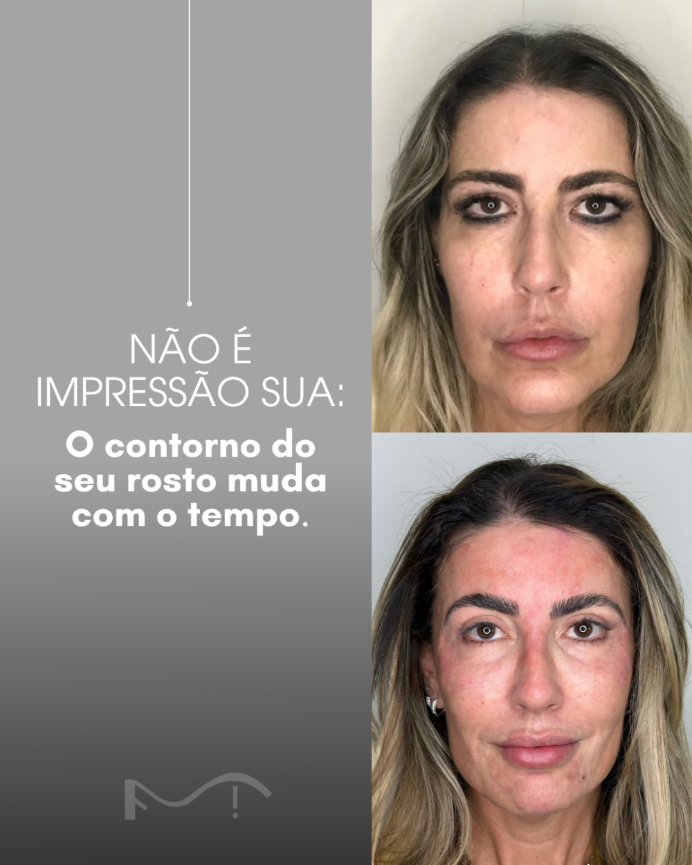 Não é impressão sua: o contorno do seu rosto muda com o tempo!
