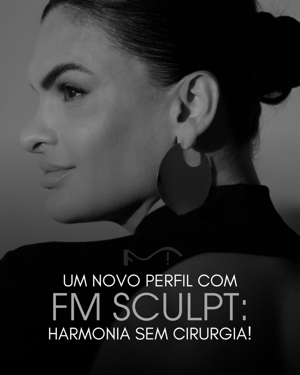 Um novo perfil com FM SCULPT: harmonia sem cirurgia!
