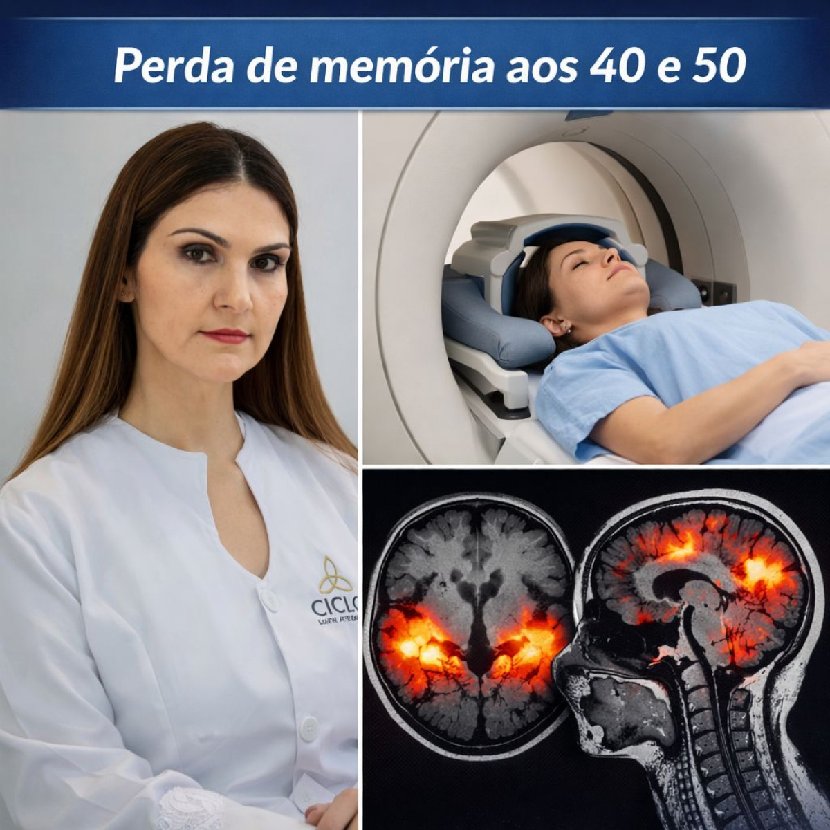 Perda de memória aos 40 e 50: um alerta que precisa ser investigado