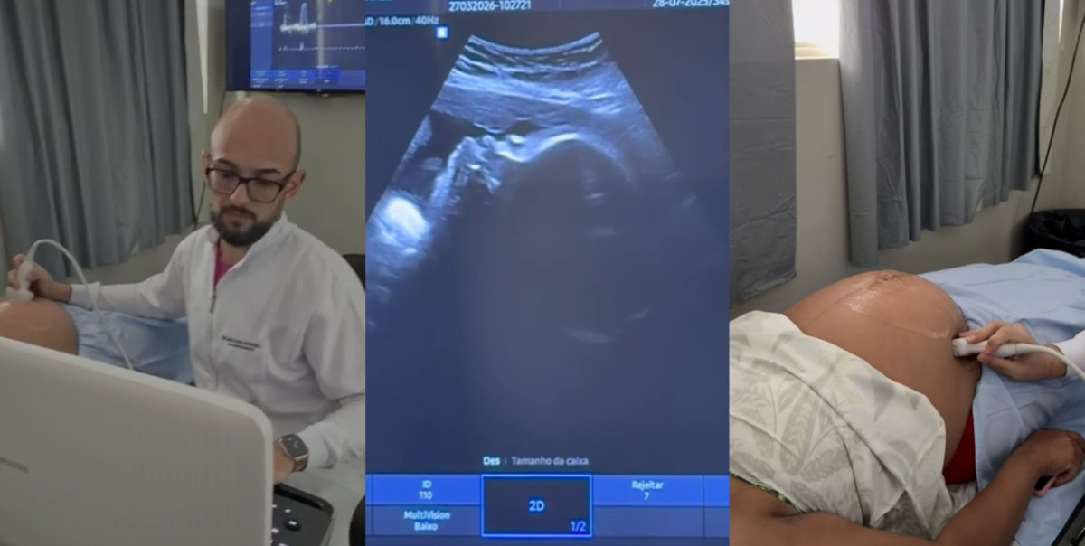 Prefeitura de Arcos amplia cuidado com gestantes e oferece três tipos de exames de ultrassom